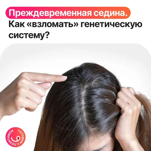 Седина в молодом возрасте. Дело в генетике?